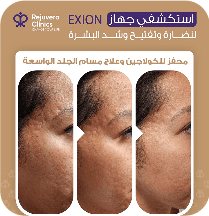 لقطة من معرض ريجوفيرا 2