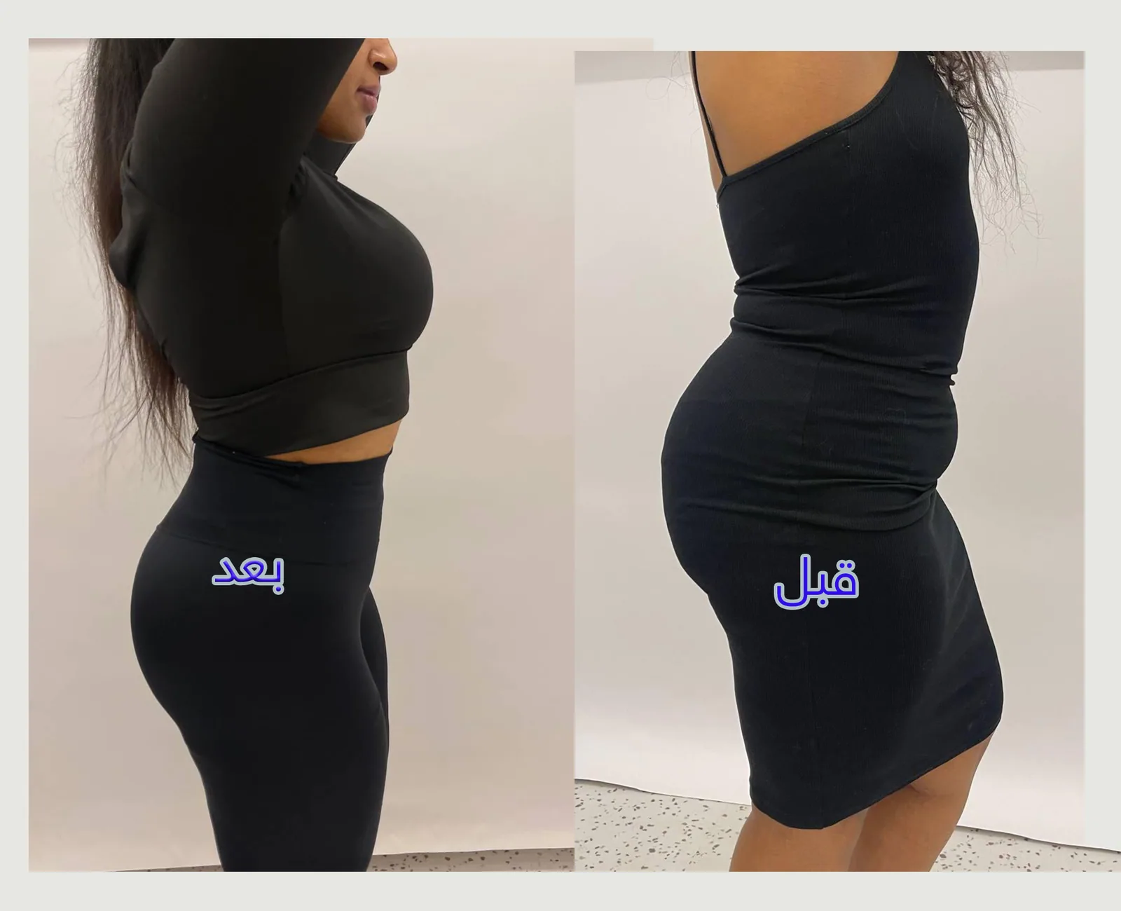 تنسيق القوام